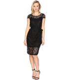 Jessica Simpson Scalloped Lace Dress (black) Women's Dress