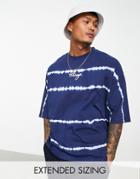 Asos Design Oversized T-shirt In Tie Dye Blue With Chicago City Print