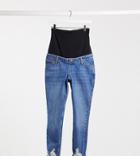 Topshop Maternity Mom Rip Hem Overbump Jeans In Mid Wash-blues