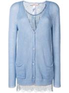 Twin-set Lace Cardigan - Blue