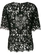 John Richmond Scalloped Lace Top - Black