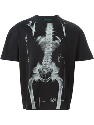Jean Paul Gaultier Vintage 'x-ray' Printed T-shirt, Men's, Size: Large, Black
