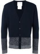 Stephan Schneider Striped Button Down Cardigan