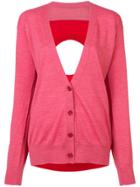 Mm6 Maison Margiela Cut Out Back Cardigan - Red