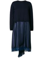 Semicouture Lace Detailed Day Dress - Blue