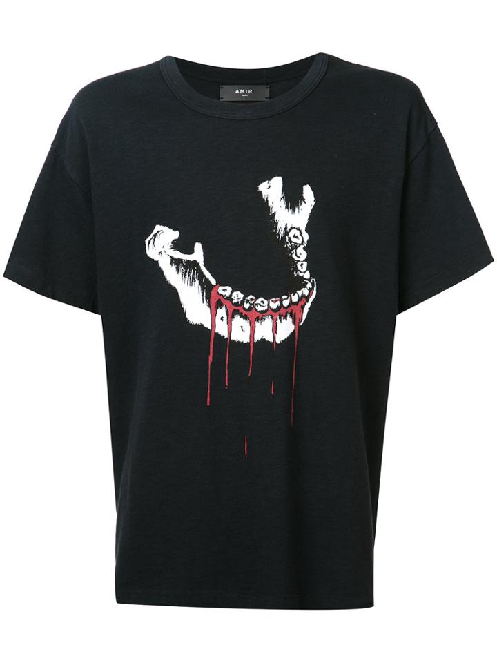 Amiri Jaw Print T-shirt - Black