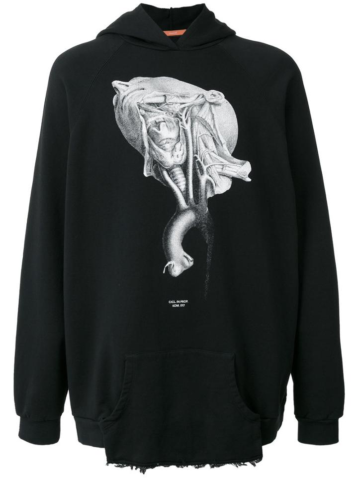 Komakino - Printed Hoodie - Men - Cotton - S, Black, Cotton