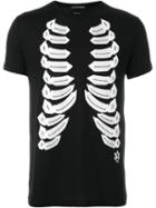 Alexander Mcqueen Ribcage Print T-shirt