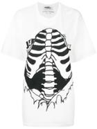 Jeremy Scott Skeleton T-shirt - White
