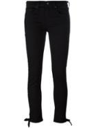 Rag & Bone /jean - Knot Detail Skinny Jeans - Women - Cotton/polyurethane - 26, Women's, Black, Cotton/polyurethane