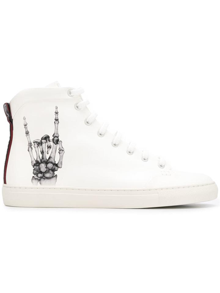 Bally Bally Herculesxfunk White Black Furs & Skins->calf Leather