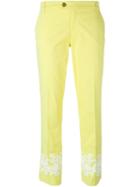 Tory Burch Ankles Detail Cropped Trousers