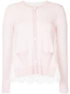 Onefifteen Lace Panel Buttoned Cardigan - Pink
