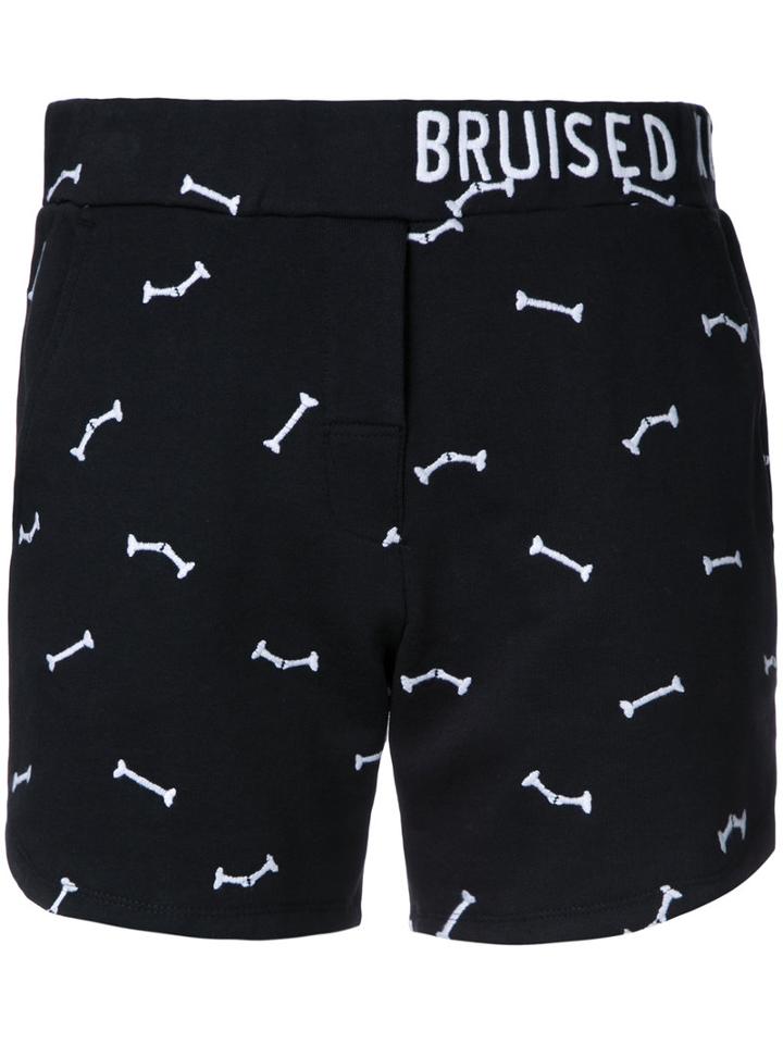 Zoe Karssen Bruised Not Broken Shorts, Women's, Size: Xs, Black, Cotton