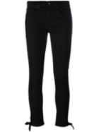 Rag & Bone /jean - Knot Detail Skinny Jeans - Women - Cotton/polyurethane - 28, Black, Cotton/polyurethane