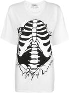 Jeremy Scott Rib Cage Print T-shirt - White