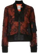 Maison Mihara Yasuhiro Lace Layer Bomber Jacket - Black