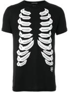 Alexander Mcqueen Ribcage Print T-shirt - Black