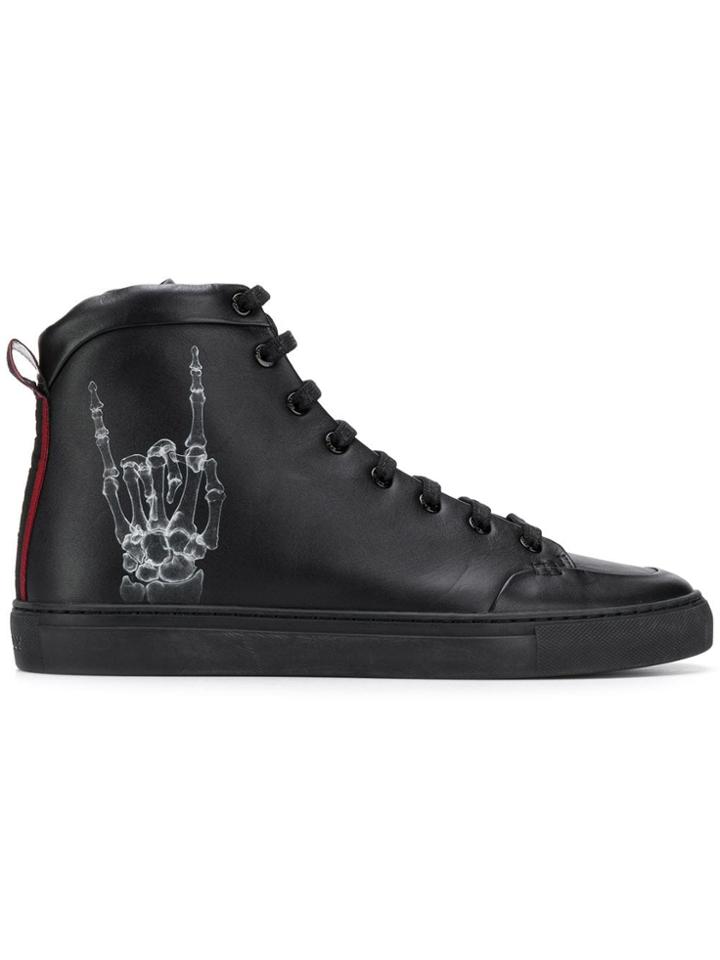 Bally Bally Herculesxfunk Black Blanc Furs & Skins->calf Leather