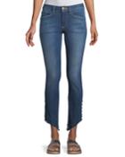 Loren Kaylor Skinny Jeans W/ Grommet Asymmetric Hem
