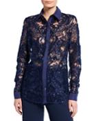 Lace Button-front