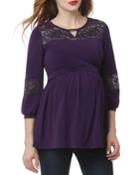 Maternity Niki Lace Accent Babydoll Top