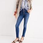 Madewell 10 High-rise Skinny Jeans: Chewed-hem Edition