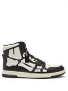 Amiri - Skel Top Leather High-top Trainers - Mens - Black