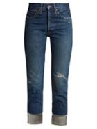 Matchesfashion.com Chimala - High Rise Distressed Jeans - Womens - Blue