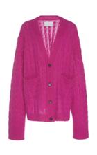 Matthew Adams Dolan Oversized Cardigan