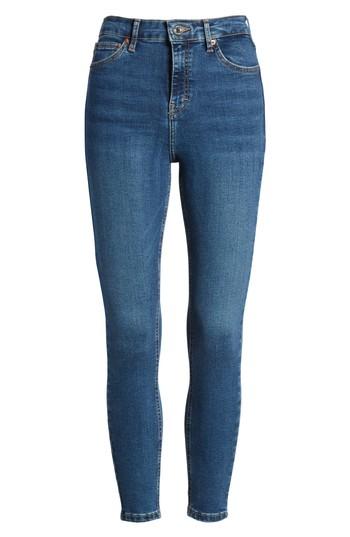 Women's Topshop Moto Jamie Jeans W X 32l (fits Like 31-32w) - Blue