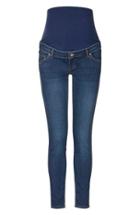 Women's Topshop 'leigh' Ankle Maternity Jeans