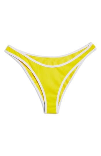Women's Topshop Contrast High Leg Bikini Bottoms - Yellow