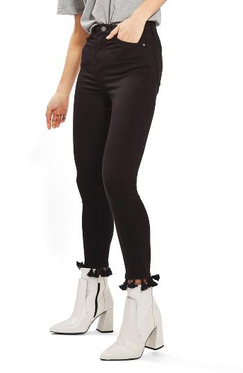 Women's Topshop Jamie Tassel Hem Skinny Jeans X 30 - Black