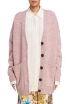 Women's Acne Studios Sahar Oversized Button Cardigan