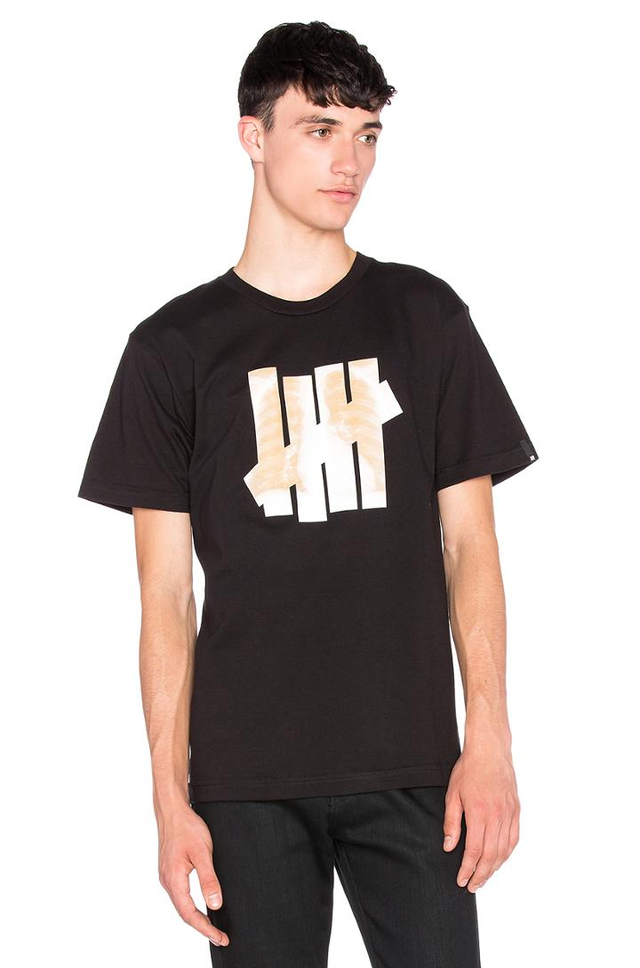 X-ray Tee