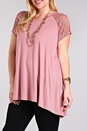  Lace Baseball Tunic