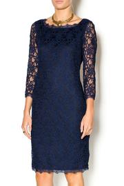  Lovely Lace Dress