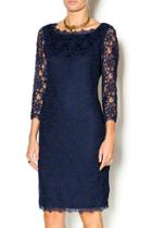  Lovely Lace Dress
