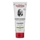 Thayers Natural Remedies Witch Hazel Lemon Blemish Clearing Cleanser