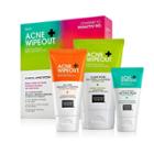 Acne Wipeout Clinical System Facial Treatment