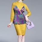 Set: Lace Dress + Patterned Camisole