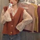 Scalloped Buttoned Knit Vest / Long-sleeve Lace Top