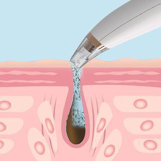 Electric Acne Blackhead Cleansing Instrument