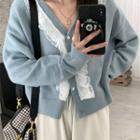 V-neck Lace Button-up Cardigan