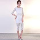 Set: Elbow Sleeve Scallop Hem Top + Midi Lace Skirt