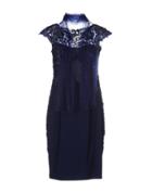 Lexus Knee-length Dresses