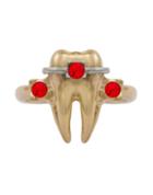Schield Rings