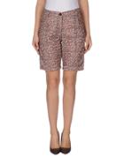 Soallure Bermudas