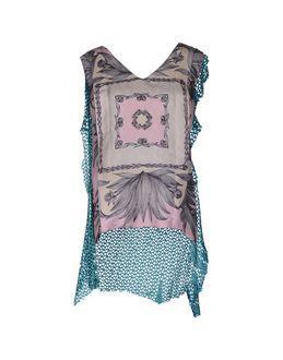 Alice San Diego Tops